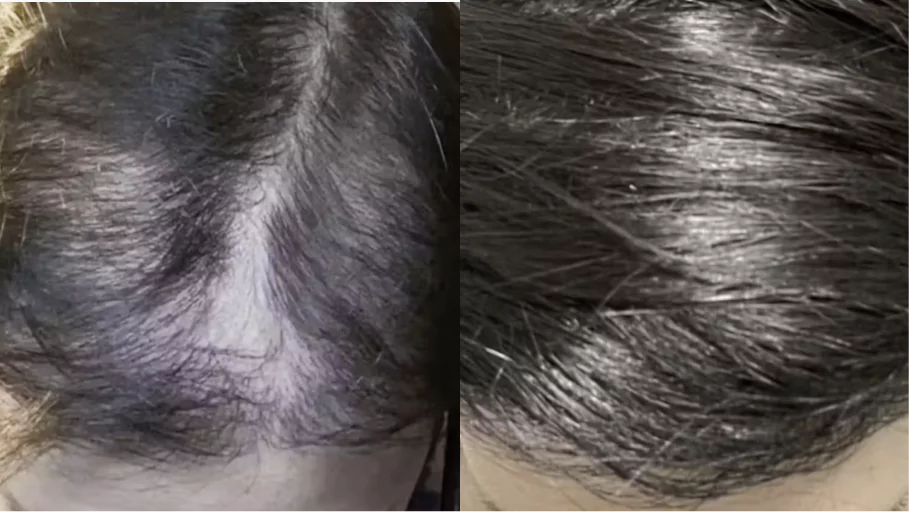 Close-up of two hairstyles with slicked-back dark hair, side by side.